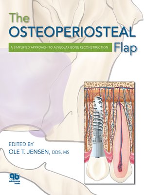 cover image of The Osteoperiosteal Flap